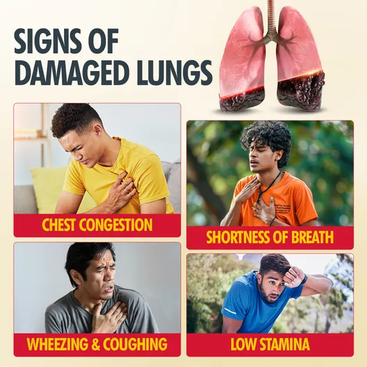 Fast&Up Lung Detox N-Acetylcysteine + Vitamin C Strawberry Flavour, 20 Effervescent Tablets | For Lung Health - Image 7